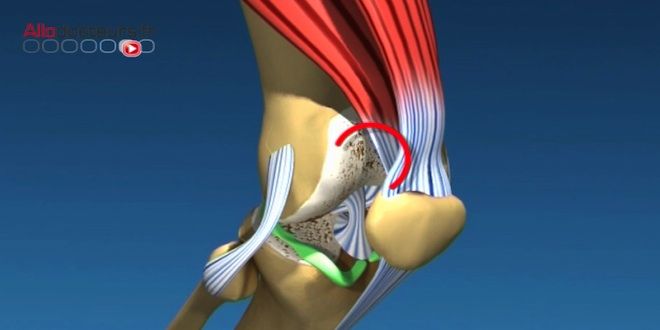 Arthrose, halte aux idées reçues ! www.allodocteurs.fr